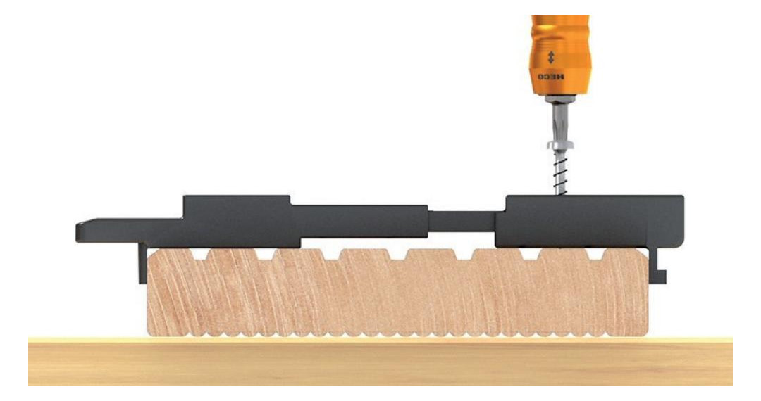 Bild HECO-Clipperset 50 St, 150St.4,0x25,100S t.4,0x30-3